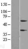 Western blot validation of overexpression lysate (Cat# LY407082) using anti-DDK antibody (Cat# TA50011-100). Left: Cell lysates from un-transfected HEK293T cells; Right: Cell lysates from HEK293T cells transfected with RC207631 using transfection reagent MegaTran 2.0 (Cat# TT210002).