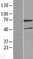 Western blot validation of overexpression lysate (Cat# LY414858) using anti-DDK antibody (Cat# TA50011-100). Left: Cell lysates from un-transfected HEK293T cells; Right: Cell lysates from HEK293T cells transfected with RC207453 using transfection reagent MegaTran 2.0 (Cat# TT210002).
