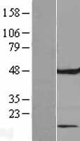 Western blot validation of overexpression lysate (Cat# LY407471) using anti-DDK antibody (Cat# TA50011-100). Left: Cell lysates from un-transfected HEK293T cells; Right: Cell lysates from HEK293T cells transfected with RC207505 using transfection reagent MegaTran 2.0 (Cat# TT210002).