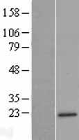 Western blot validation of overexpression lysate (Cat# LY406075) using anti-DDK antibody (Cat# TA50011-100). Left: Cell lysates from un-transfected HEK293T cells; Right: Cell lysates from HEK293T cells transfected with RC207645 using transfection reagent MegaTran 2.0 (Cat# TT210002).