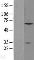 Western blot validation of overexpression lysate (Cat# LY423402) using anti-DDK antibody (Cat# TA50011-100). Left: Cell lysates from un-transfected HEK293T cells; Right: Cell lysates from HEK293T cells transfected with RC207541 using transfection reagent MegaTran 2.0 (Cat# TT210002).