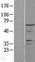 Western blot validation of overexpression lysate (Cat# LY413996) using anti-DDK antibody (Cat# TA50011-100). Left: Cell lysates from un-transfected HEK293T cells; Right: Cell lysates from HEK293T cells transfected with RC207746 using transfection reagent MegaTran 2.0 (Cat# TT210002).