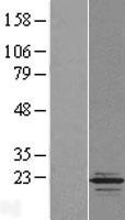 Western blot validation of overexpression lysate (Cat# LY406282) using anti-DDK antibody (Cat# TA50011-100). Left: Cell lysates from un-transfected HEK293T cells; Right: Cell lysates from HEK293T cells transfected with RC207939 using transfection reagent MegaTran 2.0 (Cat# TT210002).