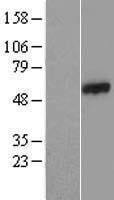 Western blot validation of overexpression lysate (Cat# LY409729) using anti-DDK antibody (Cat# TA50011-100). Left: Cell lysates from un-transfected HEK293T cells; Right: Cell lysates from HEK293T cells transfected with RC207167 using transfection reagent MegaTran 2.0 (Cat# TT210002).