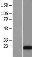 Western blot validation of overexpression lysate (Cat# LY406534) using anti-DDK antibody (Cat# TA50011-100). Left: Cell lysates from un-transfected HEK293T cells; Right: Cell lysates from HEK293T cells transfected with RC207335 using transfection reagent MegaTran 2.0 (Cat# TT210002).