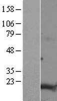 Western blot validation of overexpression lysate (Cat# LY407111) using anti-DDK antibody (Cat# TA50011-100). Left: Cell lysates from un-transfected HEK293T cells; Right: Cell lysates from HEK293T cells transfected with RC207243 using transfection reagent MegaTran 2.0 (Cat# TT210002).