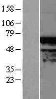 Western blot validation of overexpression lysate (Cat# LY407908) using anti-DDK antibody (Cat# TA50011-100). Left: Cell lysates from un-transfected HEK293T cells; Right: Cell lysates from HEK293T cells transfected with RC207361 using transfection reagent MegaTran 2.0 (Cat# TT210002).