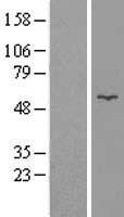 Western blot validation of overexpression lysate (Cat# LY404332) using anti-DDK antibody (Cat# TA50011-100). Left: Cell lysates from un-transfected HEK293T cells; Right: Cell lysates from HEK293T cells transfected with RC207264 using transfection reagent MegaTran 2.0 (Cat# TT210002).