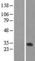 Western blot validation of overexpression lysate (Cat# LY406197) using anti-DDK antibody (Cat# TA50011-100). Left: Cell lysates from un-transfected HEK293T cells; Right: Cell lysates from HEK293T cells transfected with RC208085 using transfection reagent MegaTran 2.0 (Cat# TT210002).