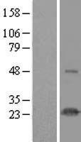 Western blot validation of overexpression lysate (Cat# LY413994) using anti-DDK antibody (Cat# TA50011-100). Left: Cell lysates from un-transfected HEK293T cells; Right: Cell lysates from HEK293T cells transfected with RC208009 using transfection reagent MegaTran 2.0 (Cat# TT210002).