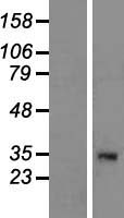 Western blot validation of overexpression lysate (Cat# LY405912) using anti-DDK antibody (Cat# TA50011-100). Left: Cell lysates from un-transfected HEK293T cells; Right: Cell lysates from HEK293T cells transfected with RC223607 using transfection reagent MegaTran 2.0 (Cat# TT210002).