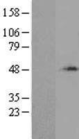 Western blot validation of overexpression lysate (Cat# LY424049) using anti-DDK antibody (Cat# TA50011-100). Left: Cell lysates from un-transfected HEK293T cells; Right: Cell lysates from HEK293T cells transfected with RC201997 using transfection reagent MegaTran 2.0 (Cat# TT210002).