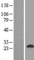 Western blot validation of overexpression lysate (Cat# LY405921) using anti-DDK antibody (Cat# TA50011-100). Left: Cell lysates from un-transfected HEK293T cells; Right: Cell lysates from HEK293T cells transfected with RC206729 using transfection reagent MegaTran 2.0 (Cat# TT210002).