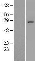 Western blot validation of overexpression lysate (Cat# LY404860) using anti-DDK antibody (Cat# TA50011-100). Left: Cell lysates from un-transfected HEK293T cells; Right: Cell lysates from HEK293T cells transfected with RC207840 using transfection reagent MegaTran 2.0 (Cat# TT210002).