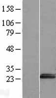 Western blot validation of overexpression lysate (Cat# LY408279) using anti-DDK antibody (Cat# TA50011-100). Left: Cell lysates from un-transfected HEK293T cells; Right: Cell lysates from HEK293T cells transfected with RC209294 using transfection reagent MegaTran 2.0 (Cat# TT210002).