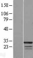 Western blot validation of overexpression lysate (Cat# LY421886) using anti-DDK antibody (Cat# TA50011-100). Left: Cell lysates from un-transfected HEK293T cells; Right: Cell lysates from HEK293T cells transfected with RC209179 using transfection reagent MegaTran 2.0 (Cat# TT210002).