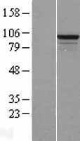 Western blot validation of overexpression lysate (Cat# LY404948) using anti-DDK antibody (Cat# TA50011-100). Left: Cell lysates from un-transfected HEK293T cells; Right: Cell lysates from HEK293T cells transfected with RC209292 using transfection reagent MegaTran 2.0 (Cat# TT210002).