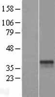 Western blot validation of overexpression lysate (Cat# LY407237) using anti-DDK antibody (Cat# TA50011-100). Left: Cell lysates from un-transfected HEK293T cells; Right: Cell lysates from HEK293T cells transfected with RC209177 using transfection reagent MegaTran 2.0 (Cat# TT210002).