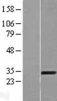 Western blot validation of overexpression lysate (Cat# LY422449) using anti-DDK antibody (Cat# TA50011-100). Left: Cell lysates from un-transfected HEK293T cells; Right: Cell lysates from HEK293T cells transfected with RC209236 using transfection reagent MegaTran 2.0 (Cat# TT210002).