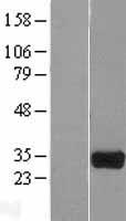Western blot validation of overexpression lysate (Cat# LY408671) using anti-DDK antibody (Cat# TA50011-100). Left: Cell lysates from un-transfected HEK293T cells; Right: Cell lysates from HEK293T cells transfected with RC208461 using transfection reagent MegaTran 2.0 (Cat# TT210002).