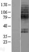 Western blot validation of overexpression lysate (Cat# LY407361) using anti-DDK antibody (Cat# TA50011-100). Left: Cell lysates from un-transfected HEK293T cells; Right: Cell lysates from HEK293T cells transfected with RC208431 using transfection reagent MegaTran 2.0 (Cat# TT210002).