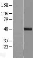 Western blot validation of overexpression lysate (Cat# LY408595) using anti-DDK antibody (Cat# TA50011-100). Left: Cell lysates from un-transfected HEK293T cells; Right: Cell lysates from HEK293T cells transfected with RC208181 using transfection reagent MegaTran 2.0 (Cat# TT210002).