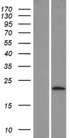 Western blot validation of overexpression lysate (Cat# LY405166) using anti-DDK antibody (Cat# TA50011-100). Left: Cell lysates from un-transfected HEK293T cells; Right: Cell lysates from HEK293T cells transfected with RC208297 using transfection reagent MegaTran 2.0 (Cat# TT210002).