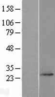 Western blot validation of overexpression lysate (Cat# LY414751) using anti-DDK antibody (Cat# TA50011-100). Left: Cell lysates from un-transfected HEK293T cells; Right: Cell lysates from HEK293T cells transfected with RC208177 using transfection reagent MegaTran 2.0 (Cat# TT210002).