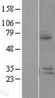 Western blot validation of overexpression lysate (Cat# LY406477) using anti-DDK antibody (Cat# TA50011-100). Left: Cell lysates from un-transfected HEK293T cells; Right: Cell lysates from HEK293T cells transfected with RC208149 using transfection reagent MegaTran 2.0 (Cat# TT210002).