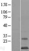 Western blot validation of overexpression lysate (Cat# LY409493) using anti-DDK antibody (Cat# TA50011-100). Left: Cell lysates from un-transfected HEK293T cells; Right: Cell lysates from HEK293T cells transfected with RC208279 using transfection reagent MegaTran 2.0 (Cat# TT210002).