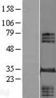 Western blot validation of overexpression lysate (Cat# LY406508) using anti-DDK antibody (Cat# TA50011-100). Left: Cell lysates from un-transfected HEK293T cells; Right: Cell lysates from HEK293T cells transfected with RC208292 using transfection reagent MegaTran 2.0 (Cat# TT210002).