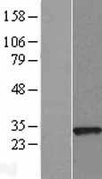 Western blot validation of overexpression lysate (Cat# LY407642) using anti-DDK antibody (Cat# TA50011-100). Left: Cell lysates from un-transfected HEK293T cells; Right: Cell lysates from HEK293T cells transfected with RC208413 using transfection reagent MegaTran 2.0 (Cat# TT210002).