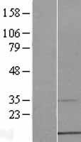 Western blot validation of overexpression lysate (Cat# LY405501) using anti-DDK antibody (Cat# TA50011-100). Left: Cell lysates from un-transfected HEK293T cells; Right: Cell lysates from HEK293T cells transfected with RC208801 using transfection reagent MegaTran 2.0 (Cat# TT210002).