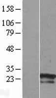 Western blot validation of overexpression lysate (Cat# LY424081) using anti-DDK antibody (Cat# TA50011-100). Left: Cell lysates from un-transfected HEK293T cells; Right: Cell lysates from HEK293T cells transfected with RC208834 using transfection reagent MegaTran 2.0 (Cat# TT210002).