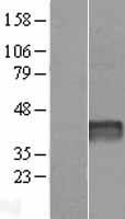 Western blot validation of overexpression lysate (Cat# LY413975) using anti-DDK antibody (Cat# TA50011-100). Left: Cell lysates from un-transfected HEK293T cells; Right: Cell lysates from HEK293T cells transfected with RC208930 using transfection reagent MegaTran 2.0 (Cat# TT210002).
