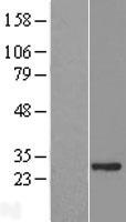 Western blot validation of overexpression lysate (Cat# LY411164) using anti-DDK antibody (Cat# TA50011-100). Left: Cell lysates from un-transfected HEK293T cells; Right: Cell lysates from HEK293T cells transfected with RC209502 using transfection reagent MegaTran 2.0 (Cat# TT210002).