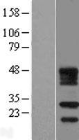 Western blot validation of overexpression lysate (Cat# LY422180) using anti-DDK antibody (Cat# TA50011-100). Left: Cell lysates from un-transfected HEK293T cells; Right: Cell lysates from HEK293T cells transfected with RC209470 using transfection reagent MegaTran 2.0 (Cat# TT210002).