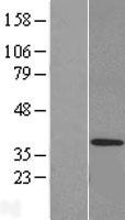 Western blot validation of overexpression lysate (Cat# LY418056) using anti-DDK antibody (Cat# TA50011-100). Left: Cell lysates from un-transfected HEK293T cells; Right: Cell lysates from HEK293T cells transfected with RC209398 using transfection reagent MegaTran 2.0 (Cat# TT210002).