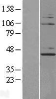 Western blot validation of overexpression lysate (Cat# LY404768) using anti-DDK antibody (Cat# TA50011-100). Left: Cell lysates from un-transfected HEK293T cells; Right: Cell lysates from HEK293T cells transfected with RC209014 using transfection reagent MegaTran 2.0 (Cat# TT210002).