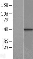 Western blot validation of overexpression lysate (Cat# LY413670) using anti-DDK antibody (Cat# TA50011-100). Left: Cell lysates from un-transfected HEK293T cells; Right: Cell lysates from HEK293T cells transfected with RC220679 using transfection reagent MegaTran 2.0 (Cat# TT210002).