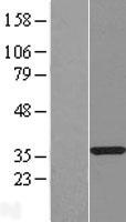 Western blot validation of overexpression lysate (Cat# LY410359) using anti-DDK antibody (Cat# TA50011-100). Left: Cell lysates from un-transfected HEK293T cells; Right: Cell lysates from HEK293T cells transfected with RC209041 using transfection reagent MegaTran 2.0 (Cat# TT210002).