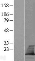Western blot validation of overexpression lysate (Cat# LY409878) using anti-DDK antibody (Cat# TA50011-100). Left: Cell lysates from un-transfected HEK293T cells; Right: Cell lysates from HEK293T cells transfected with RC209410 using transfection reagent MegaTran 2.0 (Cat# TT210002).