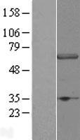Western blot validation of overexpression lysate (Cat# LY431978) using anti-DDK antibody (Cat# TA50011-100). Left: Cell lysates from un-transfected HEK293T cells; Right: Cell lysates from HEK293T cells transfected with RC228951 using transfection reagent MegaTran 2.0 (Cat# TT210002).
