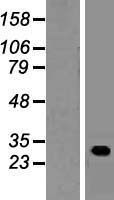 Western blot validation of overexpression lysate (Cat# LY410517) using anti-DDK antibody (Cat# TA50011-100). Left: Cell lysates from un-transfected HEK293T cells; Right: Cell lysates from HEK293T cells transfected with RC209887 using transfection reagent MegaTran 2.0 (Cat# TT210002).