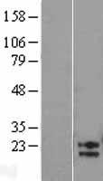 Western blot validation of overexpression lysate (Cat# LY403964) using anti-DDK antibody (Cat# TA50011-100). Left: Cell lysates from un-transfected HEK293T cells; Right: Cell lysates from HEK293T cells transfected with RC209899 using transfection reagent MegaTran 2.0 (Cat# TT210002).