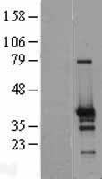 Western blot validation of overexpression lysate (Cat# LY407148) using anti-DDK antibody (Cat# TA50011-100). Left: Cell lysates from un-transfected HEK293T cells; Right: Cell lysates from HEK293T cells transfected with RC209712 using transfection reagent MegaTran 2.0 (Cat# TT210002).