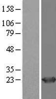 Western blot validation of overexpression lysate (Cat# LY414212) using anti-DDK antibody (Cat# TA50011-100). Left: Cell lysates from un-transfected HEK293T cells; Right: Cell lysates from HEK293T cells transfected with RC209808 using transfection reagent MegaTran 2.0 (Cat# TT210002).