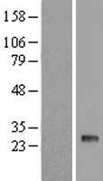 Western blot validation of overexpression lysate (Cat# LY404318) using anti-DDK antibody (Cat# TA50011-100). Left: Cell lysates from un-transfected HEK293T cells; Right: Cell lysates from HEK293T cells transfected with RC209585 using transfection reagent MegaTran 2.0 (Cat# TT210002).