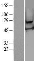 Western blot validation of overexpression lysate (Cat# LY410438) using anti-DDK antibody (Cat# TA50011-100). Left: Cell lysates from un-transfected HEK293T cells; Right: Cell lysates from HEK293T cells transfected with RC208649 using transfection reagent MegaTran 2.0 (Cat# TT210002).