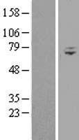 Western blot validation of overexpression lysate (Cat# LY411007) using anti-DDK antibody (Cat# TA50011-100). Left: Cell lysates from un-transfected HEK293T cells; Right: Cell lysates from HEK293T cells transfected with RC208690 using transfection reagent MegaTran 2.0 (Cat# TT210002).